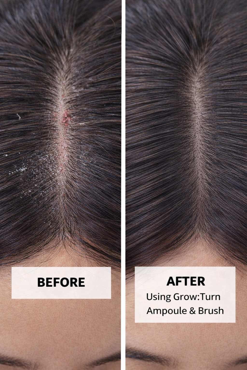 Zenova Growturn Hair Growth Serum Brush
